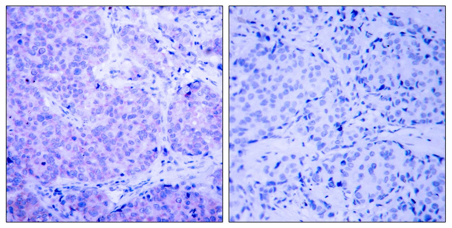 PDPK1 / PDK1 Antibody (phospho-Ser241)