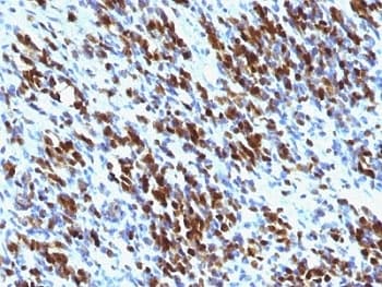 MYOG / Myogenin Antibody (aa30-224, clone MGN185 + F5D)