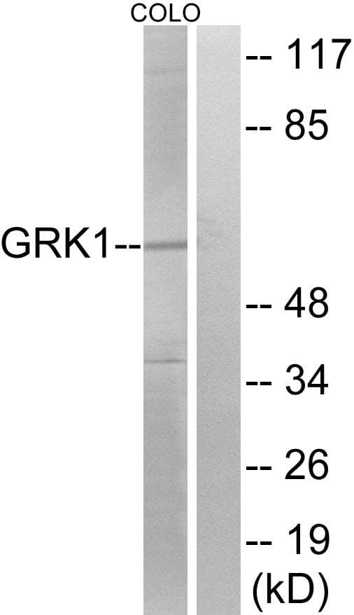 Rhodopsin Kinase / GRK1 Antibody (p21)