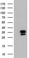 MMS21 / NSMCE2 Antibody (clone OTI4H9)