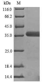 Mouse GNAO1 Protein (Recombinant)