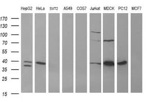 IHC-plus™ ARG2 / Arginase 2 Antibody (clone 3G5)