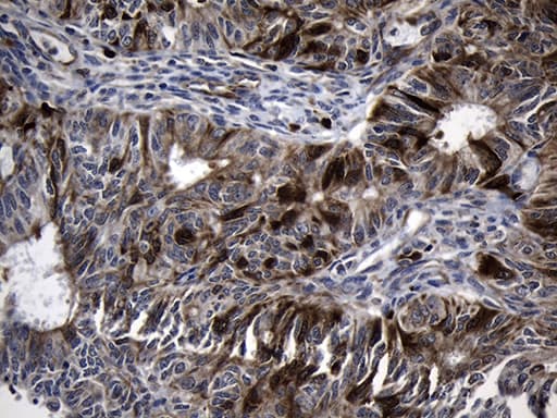 Monoclonal Mouse anti-Human RRM2 Antibody (clone OTI3D3, Carrier-free, IHC, WB)