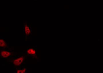 Polyclonal Rabbit anti-Human MED1 / TRAP220 Antibody (IF, WB)
