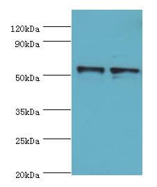 Polyclonal Rabbit anti-Human SPTLC1 / HSN1 Antibody (aa37-310, IHC, WB)