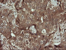 TRMT2A Antibody (clone OTI1C3)