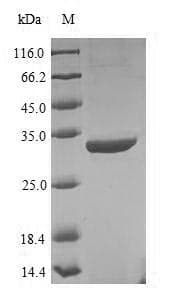 Bacteriophage T4 UvsY Protein (Recombinant 6His-SUMO, N-terminus)