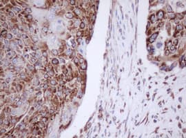 IF3mt / MTIF3 Antibody (aa56-278, clone OTI4B6)