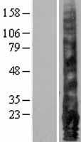 EMP1 Protein (Over-Expression Lysate Myc-DDK (Flag))