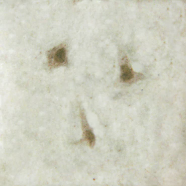 PRKDC / DNA-PKcs Antibody (phospho-Thr2647)