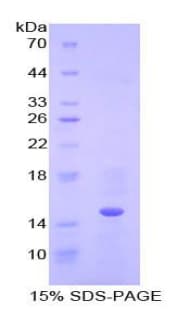 Human CSTB / Cystatin B / Stefin B Protein (Recombinant His-T7)