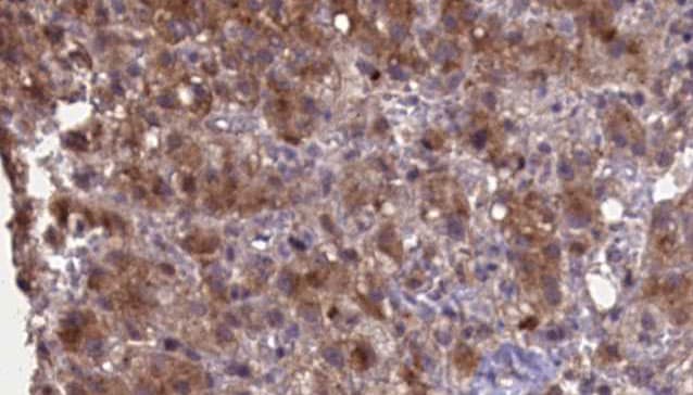 GRIK2 / GLUR6 Antibody
