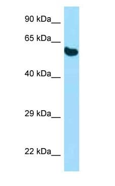 PDIA3 / ERp57 Antibody (aa82-131)