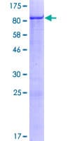 Human ZNF543 Protein (Recombinant GST)