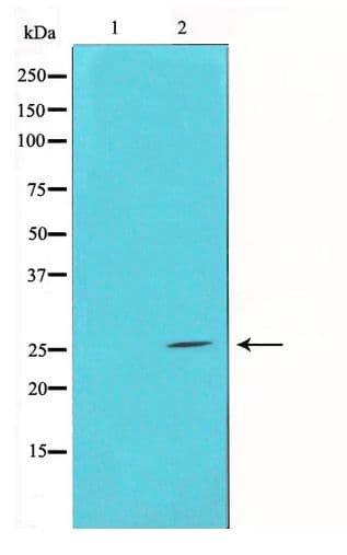 BCL2L11 / BIM Antibody