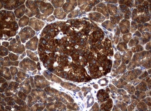 NME1 / NM23 Antibody (clone UMAB93, Carrier-free)
