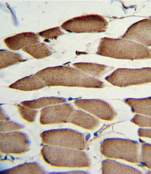 Polyclonal Rabbit anti-Human WNT5B Antibody (aa153-182, IHC, WB)