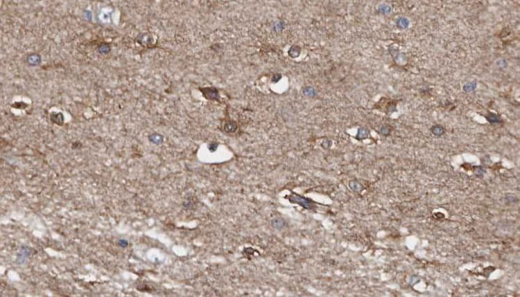 AGK Antibody
