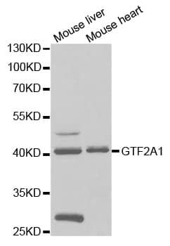 GTF2A1 / TFIIA Antibody