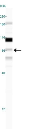 NBN / Nibrin Antibody (aa400-650, clone 7E4A2)