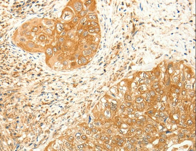 Polyclonal Rabbit anti-Human RARRES1 Antibody (IHC)