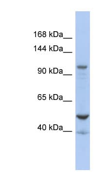 DDX58 / RIG-1 / RIG-I Antibody (aa827-876)