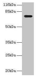 KBTBD2 Antibody (aa182-406)