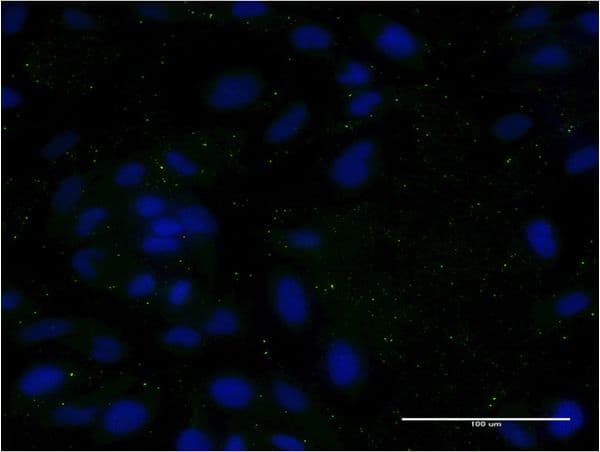 Monoclonal Mouse anti-Human APOC3 / Apolipoprotein C III Antibody (clone 8H7, IF, WB)