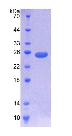 Human NOMO1 / PM5 Protein (Recombinant His-T7)