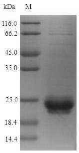 Staphylococcus aureus 30 kDa neutral phosphatase Protein (Recombinant 6His-SUMO, N-terminus)