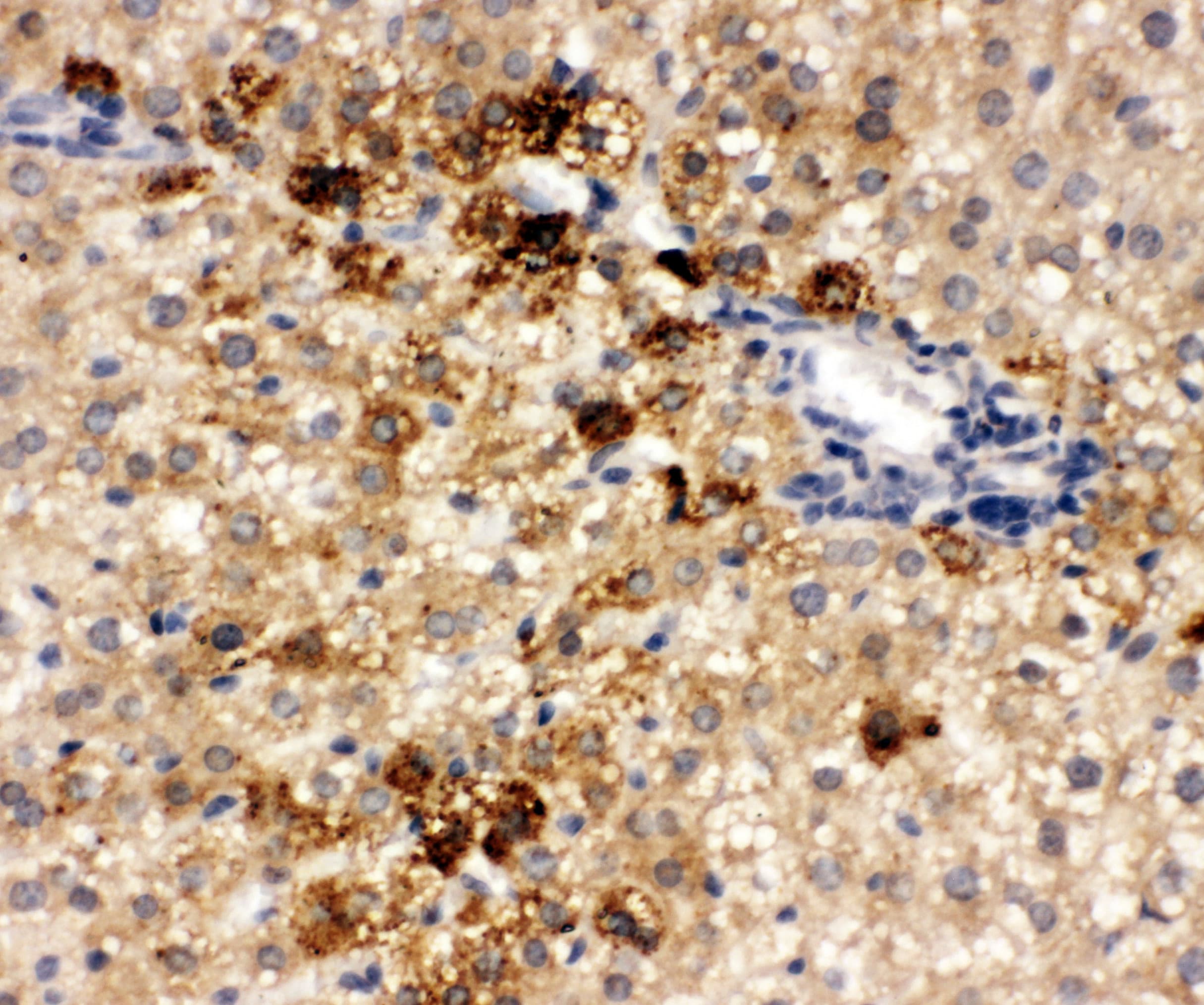 Polyclonal Rabbit anti-Human ONECUT1 / HNF6 Antibody (aa187-203, IHC, WB)