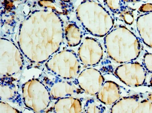 Polyclonal Rabbit anti-Human EFNA3 / Ephrin A3 Antibody (aa23-214, IHC)