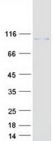 Human CALCOCO1 / CoCoa Protein (Recombinant Myc-DDK (Flag))