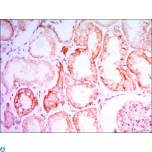 Monoclonal Mouse anti-Human PTHR / PTHR1 Antibody (IHC, IF, WB)