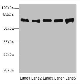 SPDL1 / CCDC99 Antibody