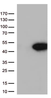 ARG1 / Arginase 1 Antibody (clone OTI3C8)