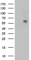 ALDH3A2 Antibody (clone OTI2D3)