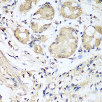NID1 / Entactin / Nidogen-1 Antibody