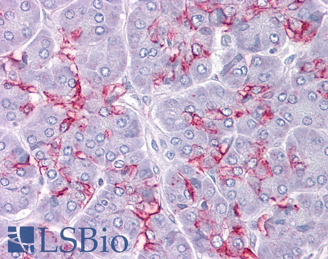 IHC-plus™ CTSK / Cathepsin K Antibody (clone 2F1)