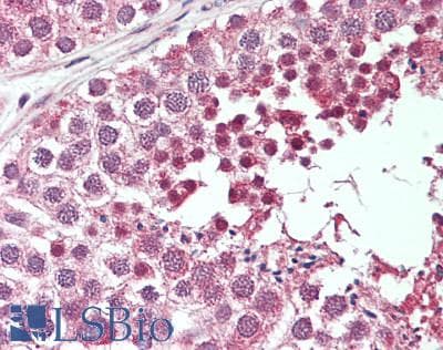 IHC-plus™ Treacle / TCOF1 Antibody (N-Terminus)