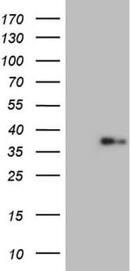 LGALS9 / Galectin 9 Antibody (clone OTI8B11)