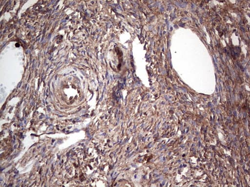 PKM2 Antibody (clone 12B9)