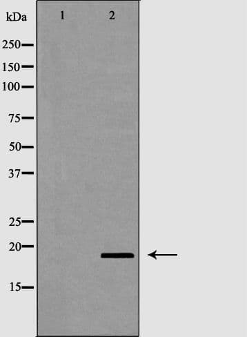 Polyclonal Rabbit anti-Human PTN / Pleiotrophin Antibody (WB)