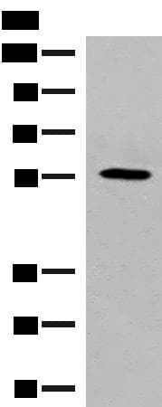 Polyclonal Rabbit anti-Human GPR22 Antibody (IHC, WB)