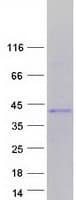 Human TLX3 Protein (Recombinant Myc-DDK (Flag))