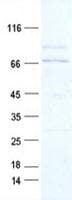 Human KDR / VEGFR2 / FLK1 Protein (Recombinant DDK,C-terminus)