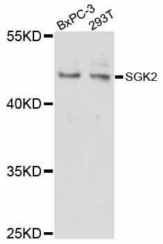 SGK2 Antibody