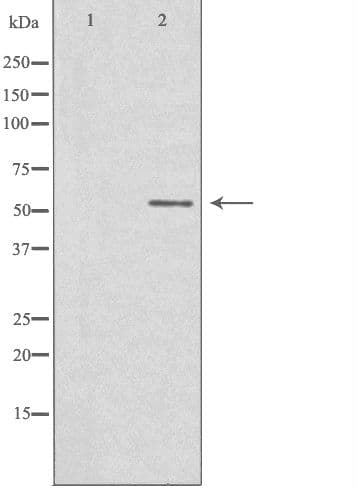 STK32C / PKE Antibody