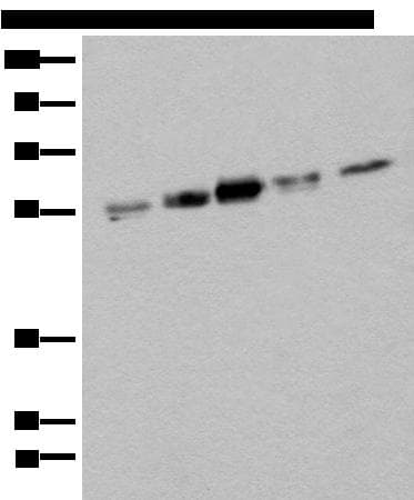 ZPR1 / ZNF259 Antibody