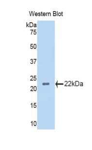 IL3RA / CD123 Antibody (aa167-331)